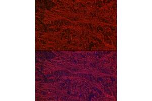 Immunofluorescence analysis of mouse brain using Neurofilament L Rabbit mAb (ABIN7268867) at dilution of 1:100 (40x lens). (NEFL anticorps)