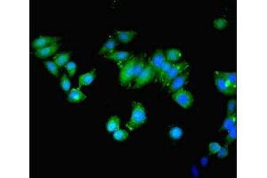Immunofluorescent analysis of HepG2 cells using ABIN7160057 at dilution of 1:100 and Alexa Fluor 488-congugated AffiniPure Goat Anti-Rabbit IgG(H+L)