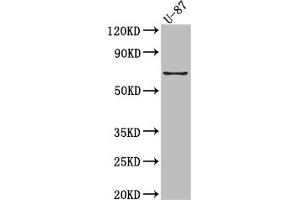 Western Blot Positive WB detected in: U-87 whole cell lysate All lanes: COX2 Antibody at 1:1000 Secondary Goat polyclonal to rabbit IgG at 1/50000 dilution Predicted band size: 69 kDa Observed band size: 69 kDa