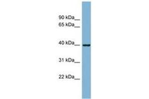 Image no. 1 for anti-ELMO/CED-12 Domain Containing 2 (ELMOD2) (AA 35-84) antibody (ABIN6742092) (ELMOD2 anticorps  (AA 35-84))