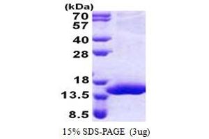 SDS-PAGE (SDS) image for Chromosome 17 Open Reading Frame 37 (C17orf37) (AA 1-112) protein (His tag) (ABIN5853168) (C17orf37 Protein (AA 1-112) (His tag))
