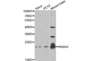 Western blot analysis of extracts of various cell lines, using RAB5A antibody. (RAB5 anticorps  (AA 1-215))