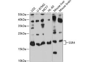 Western blot analysis of extracts of various cell lines, using SSR4 antibody (ABIN6133183, ABIN6148490, ABIN6148491 and ABIN6224060) at 1:1000 dilution. (SSR4 anticorps  (AA 24-144))