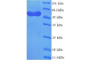 SDS-PAGE (SDS) image for WD Repeat Domain 77 (WDR77) (AA 1-312), (partial) protein (His-SUMO Tag) (ABIN5711731) (WDR77 Protein (AA 1-312, partial) (His-SUMO Tag))