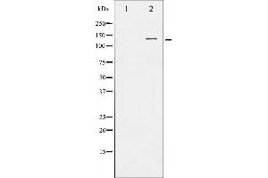 Western blot analysis of FGFR1 expression in HepG2 whole cell lysates,The lane on the left is treated with the antigen-specific peptide. (FGFR1 anticorps  (C-Term))