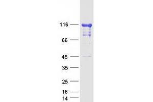Validation with Western Blot