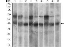 Western blot analysis using MAPK14 mouse mAb against Hela (1), HEK293 (2), A431 (3), MCF-7 (4), RAW264. (MAPK14 anticorps  (AA 299-360))