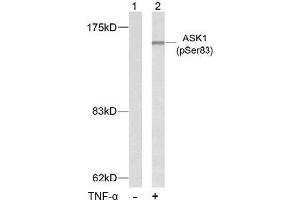 Image no. 2 for anti-Mitogen-Activated Protein Kinase Kinase Kinase 5 (MAP3K5) (pSer83) antibody (ABIN196912) (ASK1 anticorps  (pSer83))