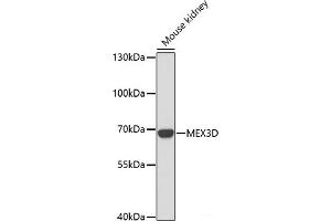 Western blot analysis of extracts of Mouse kidney using MEX3D Polyclonal Antibody at dilution of 1:1000. (MEX3D anticorps)