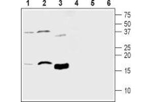 Western blot analysis of mouse brain lysate (lanes 1 and 4), rat brain lysate (lanes 2 and 5) and human recombinant MANF protein (lanes 3 and 6): - 1-3.
