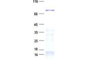 Validation with Western Blot