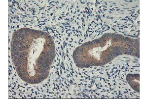 Immunohistochemical staining of paraffin-embedded Human endometrium tissue using anti-CXorf26 mouse monoclonal antibody. (CXorf26 anticorps)