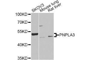 Western blot analysis of extracts of various cell lines, using PNPLA3 Antibody (ABIN2564605) at 1:1000 dilution. (PNPLA3 anticorps)