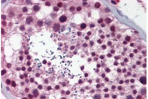 Human Testis: Formalin-Fixed, Paraffin-Embedded (FFPE)