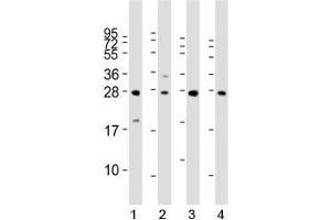 Western blot analysis of LIN28B antibody and 1) HeLa, 2) K562, 3) mouse testis and 4) NCCIT lysate. (LIN28B anticorps  (AA 95-128))