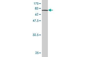 Western Blot detection against Immunogen (73. (ENO1 anticorps  (AA 1-434))