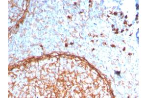 Formalin-fixed, paraffin-embedded human tonsil stained with CD11b Monospecific Mouse Monoclonal Antibody (ITGAM/3338).
