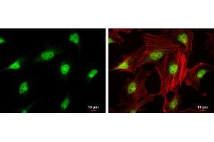 ICC/IF Image CDK4 antibody detects CDK4 protein at nucleus by immunofluorescent analysis. (CDK4 anticorps)