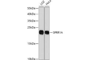 Western blot analysis of extracts of various cell lines, using SPRR1A antibody (ABIN7270369) at 1:1000 dilution. (SPRR1A anticorps)