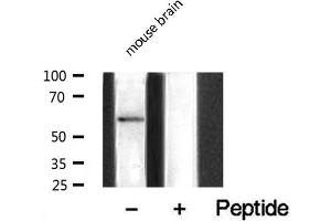 Western blot analysis on mouse brain lysate using UBXD5 Antibody (UBXN11 anticorps  (Internal Region))