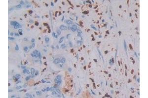 anti-Mannan-Binding Lectin Serine Peptidase 1 (MASP1) (AA 20-447) antibody