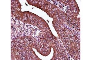 Estrogen Receptor antibody immunohistochemistry analysis in formalin fixed and paraffin embedded human uterus tissue. (Estrogen Receptor alpha anticorps  (AA 246-273))