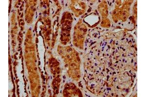 IHC image of ABIN7174060 diluted at 1:200 and staining in paraffin-embedded human kidney tissue performed on a Leica BondTM system.
