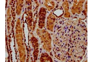 IHC image of ABIN7174060 diluted at 1:200 and staining in paraffin-embedded human kidney tissue performed on a Leica BondTM system. (RYK anticorps  (AA 494-586))