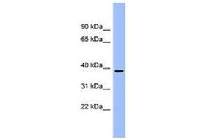 Image no. 1 for anti-Aminocarboxymuconate Semialdehyde Decarboxylase (ACMSD) (AA 251-300) antibody (ABIN6743386) (ACMSD anticorps  (AA 251-300))