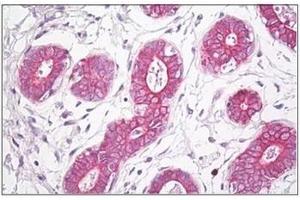 Human Breast: Formalin-Fixed, Paraffin-Embedded (FFPE)
