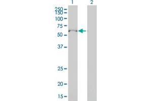 Western Blot analysis of ULK4 expression in transfected 293T cell line by ULK4 monoclonal antibody (M01), clone 4A10-1A7.