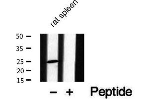 Western blot analysis of extracts from Rat spleen lysate, using CACNG1 antibody.