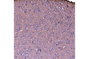IHC analysis of NEAS/SPTAN1 using anti-NEAS/SPTAN1 antibody (ABIN7600436). (SPTAN1 anticorps  (AA 1916-2472))