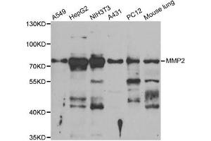 Western Blotting (WB) image for anti-Matrix Metalloproteinase 2 (MMP2) antibody (ABIN1882374) (MMP2 anticorps)