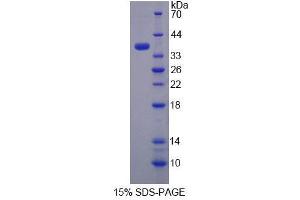 SDS-PAGE analysis of Human TST Protein.