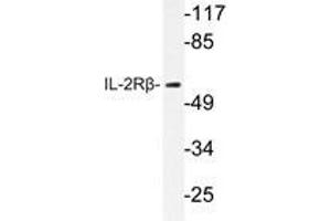Western blot analysis of IL-2Rβ antibody in extracts from HepG2 cells. (IL2 Receptor beta anticorps)