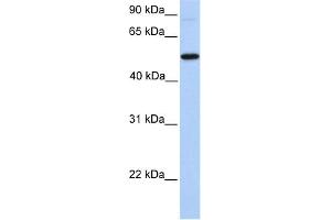 WB Suggested Anti-GALNT13 Antibody Titration:  0. (GALNT13 anticorps  (N-Term))