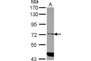 Western Blotting (WB) image for anti-Inositol-Trisphosphate 3-Kinase C (ITPKC) (Internal Region) antibody (ABIN1496062)
