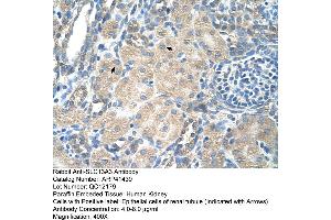 Rabbit Anti-SLC13A3 Antibody  Paraffin Embedded Tissue: Human Kidney Cellular Data: Epithelial cells of renal tubule Antibody Concentration: 4. (SLC13A3 anticorps  (Middle Region))