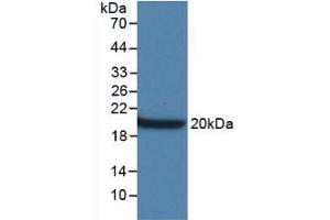 Detection of Recombinant AQP4, Mouse using Monoclonal Antibody to Aquaporin 4 (AQP4) (Aquaporin 4 anticorps  (AA 177-304))