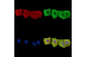 ENTPD6 Antibody staining Hela cells by IF/ICC. (ENTPD6 anticorps)