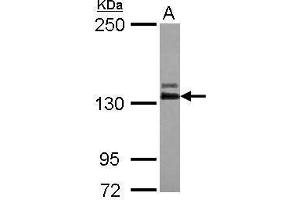 WB Image Sample (30 ug of whole cell lysate) A: IMR32 5% SDS PAGE antibody diluted at 1:1000 (ABL2 anticorps  (Center))