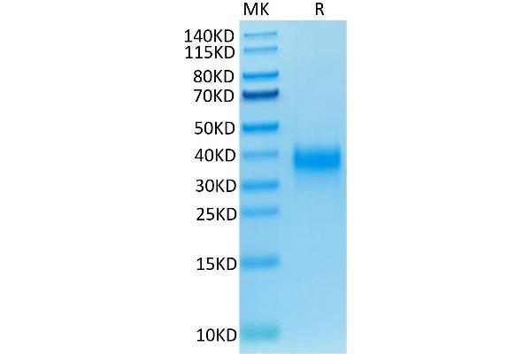 CD94 Protein (AA 34-179) (His-Avi Tag,Biotin)