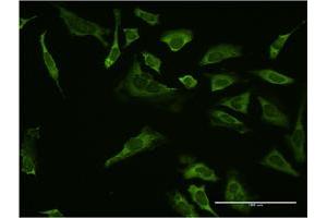 Immunofluorescence of monoclonal antibody to SP1 on HeLa cell. (SP1 anticorps  (AA 522-618))