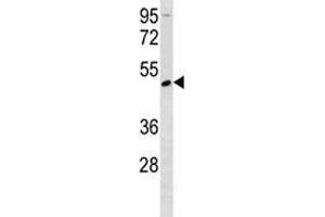 Rage antibody western blot analysis in mouse Neuro-2a lysate.