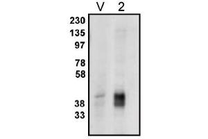 Image no. 1 for anti-Phosphatidic Acid Phosphatase Type 2C (PPAP2C) antibody (ABIN265044) (PPAP2C anticorps)