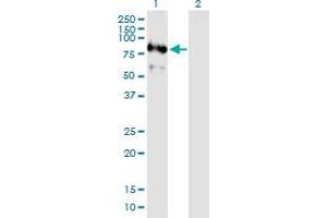 Lane 1: C1orf164 transfected lysate ( 62. (C1orf164 293T Cell Transient Overexpression Lysate(Denatured))