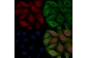 ABIN6255261 and ABIN6267114 staining Heat-shock treated Hela cells by IF/ICC.