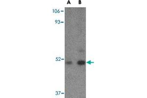 Western blot analysis of TBC1D10C in Daudi cell lysate with TBC1D10C polyclonal antibody  at (A) 1 and (B) 2 ug/mL . (Carabin anticorps  (C-Term))