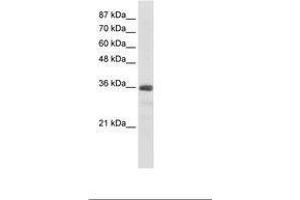 SNRNP35 anticorps  (AA 29-78)